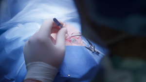 Pterygium