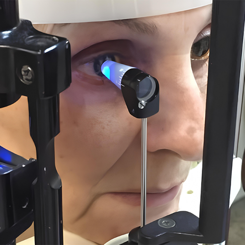 Glaucoma Diagnosis